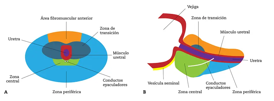 Figura 1 – Secciones transversal (A) y sagital (B) de la próstata, que muestran las diferentes zonas descritas por McNeal (adaptada de las citas 1 y 2).